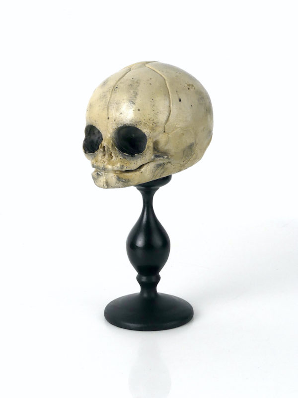 Petit crâne de fœtus sur pied (3/4)