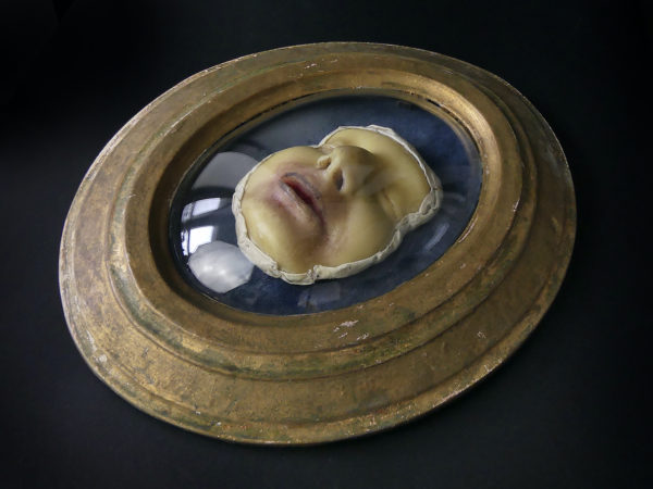 Céroplastie maladie de peau XIXe verre bombé et cadre doré (3/4)