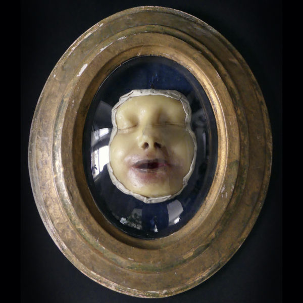 Céroplastie maladie de peau XIXe verre bombé et cadre doré (face)