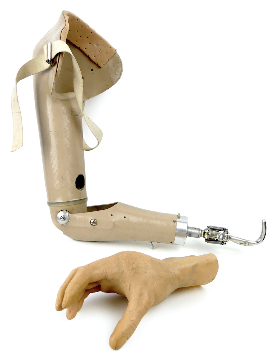 Prothèse de bras vintage avec pince mécanique et main en silicone