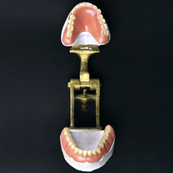 Dentier articulé de la la 2e partie du XIXe en porcelaine plâtre et laiton (ouvert face)