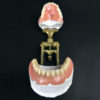 Dentier articulé de la la 2e partie du XIXe en porcelaine plâtre et laiton (ouvert face)