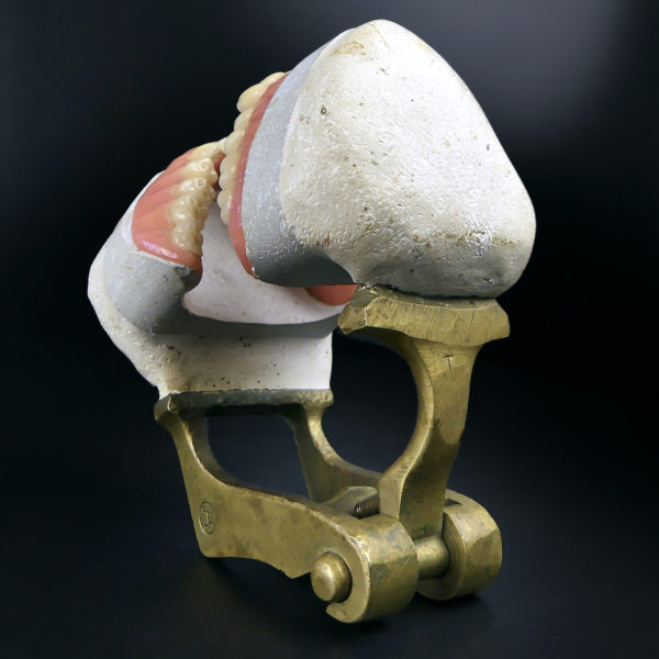 Dentier articulé de la la 2e partie du XIXe en porcelaine plâtre et laiton (dessus 3/4)