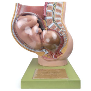 Bassin de grossesse et fœtus à échelle 1:1 en PVC Modèle anatomique SOMSO (face)
