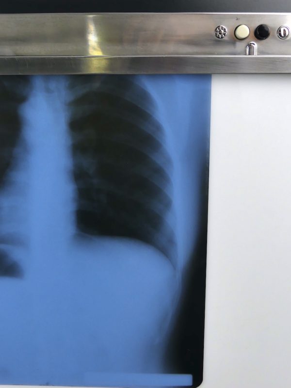 Grand négatoscope vintage tableau mural lumineux Pologne Radiologie (détail)