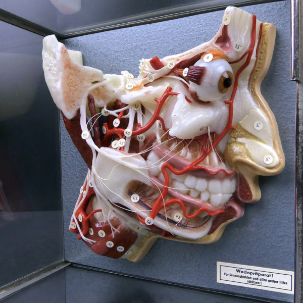 Ecorché en cire SOMSO rare demi-tête humaine dans sa vitrine de verre Allemagne (détail)